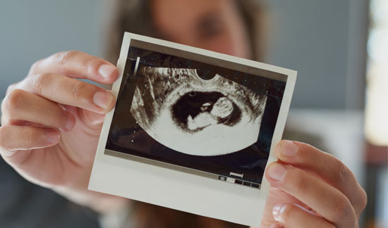 Expectant mother sharing ultrasound 